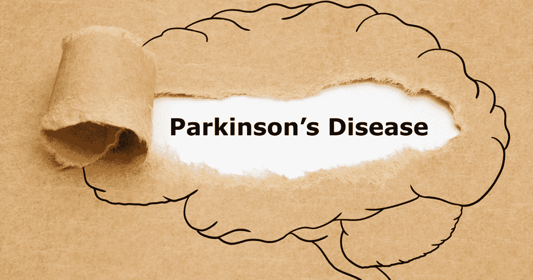 How to Cope with a Parkinson’s Disease Diagnosis