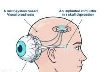 ‘Needing eyes in the back of your head …’ There was never a parent who raised any sort of a child, who didn’t declare at some point; ‘you would need eyes in the back of your head to watch them.’