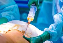 Jailed Murcia Surgeon Says Operating Movements Were Standard Practice The surgeon explained that a “rocking motion” visible in the images was a standard movement performed during liposuction procedures.